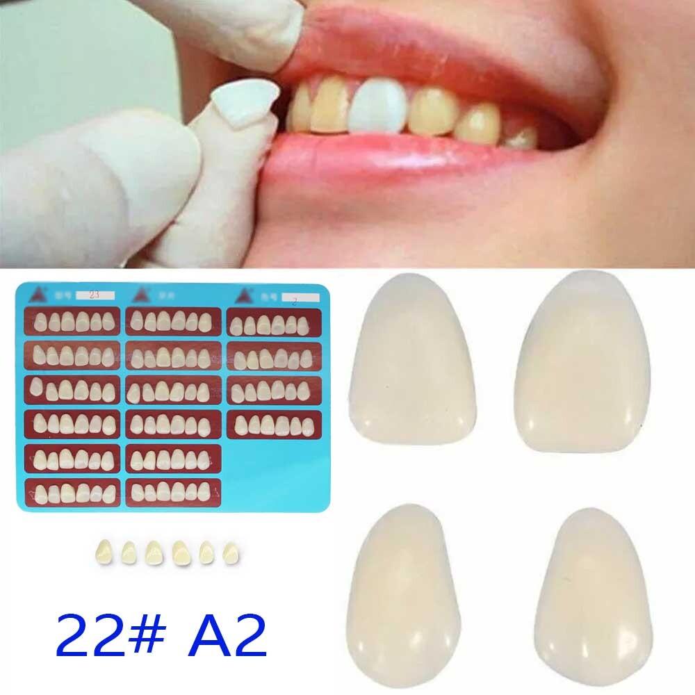 96pcs Dental Tooth Veneer Anterior Resin Thin Teeth Veneers Porcelain 22# A2 USA 96pcs Dental Tooth Veneer Anterior Resin Thin Teeth Veneers Porcelain 22# A2 USA