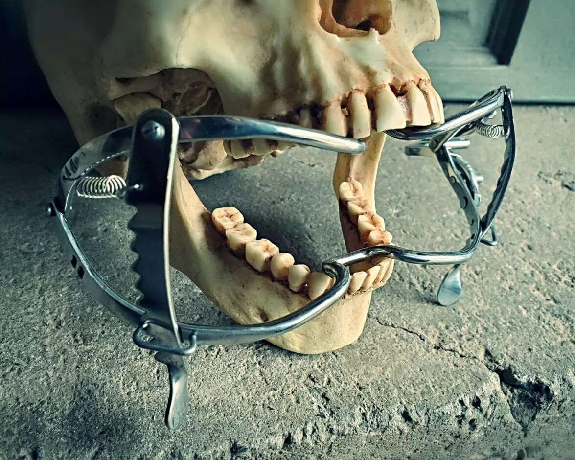Medical Mouth Gag, Mouth Spreader Display, Vintage Medical Style, Oddities Medical Mouth Gag, Mouth Spreader Display, Vintage Medical Style, Oddities